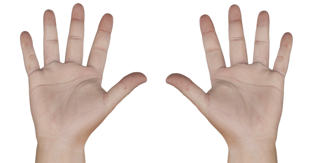 Bilateral (Both Wrists) Carpal Tunnel Syndrome Surgery