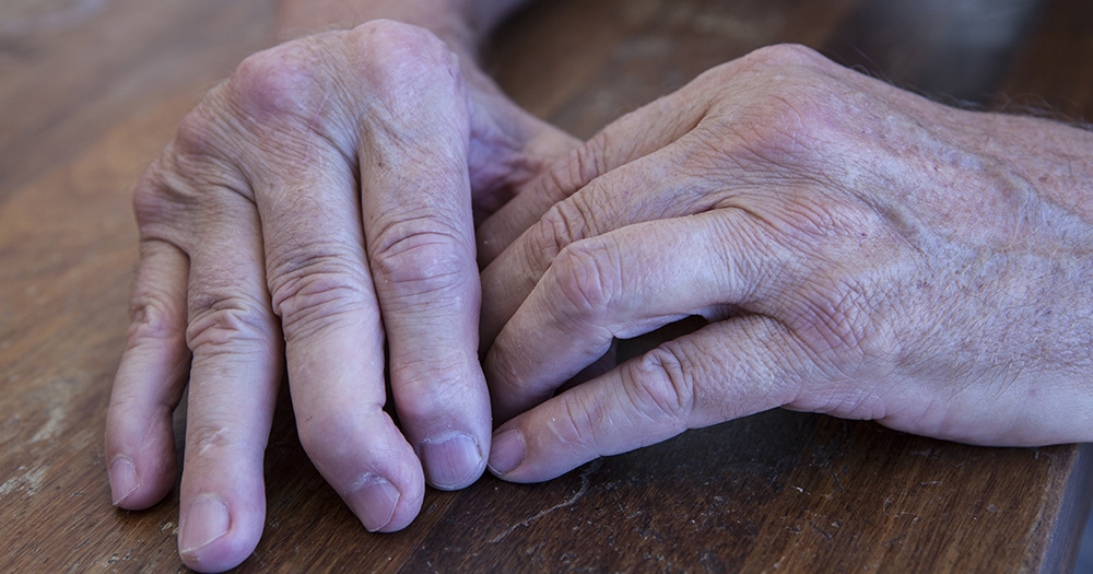 How a Boutonnière Deformity Is Treated