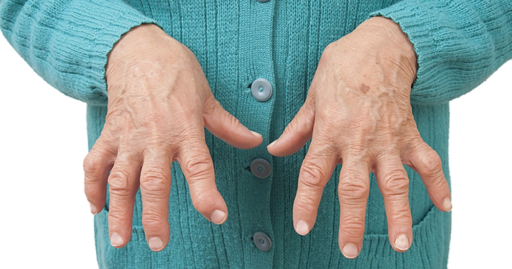 Is It Likely That I’ll Have Arthritis if It Runs in My Family?