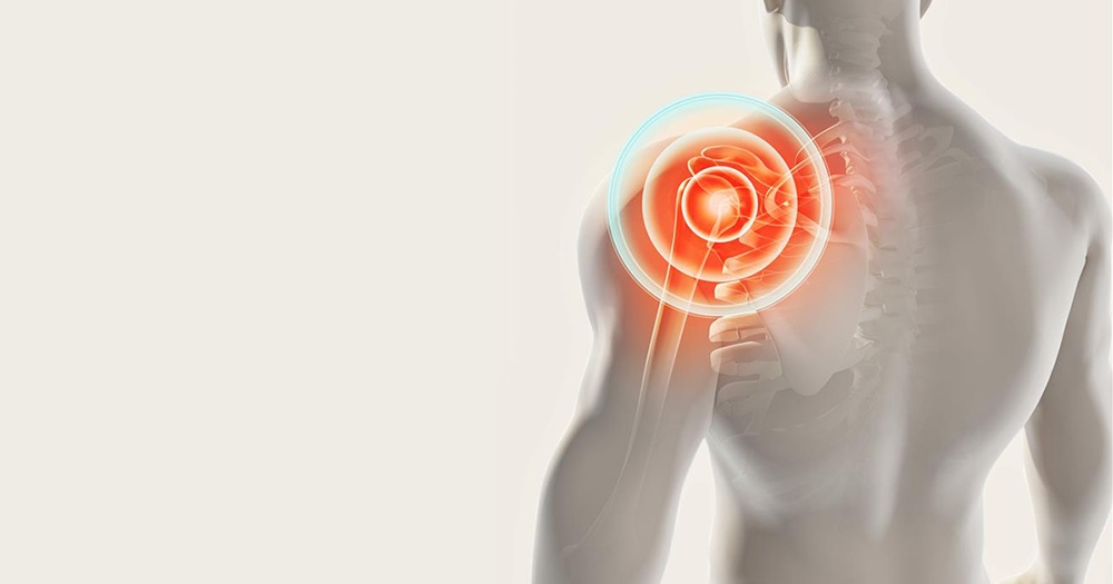 Understanding Shoulder Arthritis: Causes, Symptoms, and Treatment Options